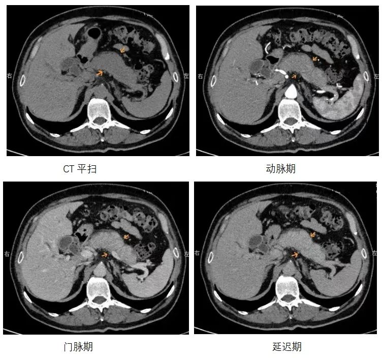 CT、磁共振价格腰斩 医疗设备集采“没那么简单”