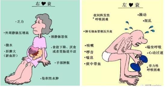 研究:睡眠规律有助于心力衰竭患者康复