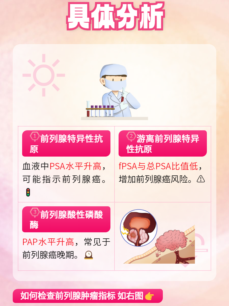 专家：前列腺癌患者应关注PSA 全程管理带来长期高质量生存