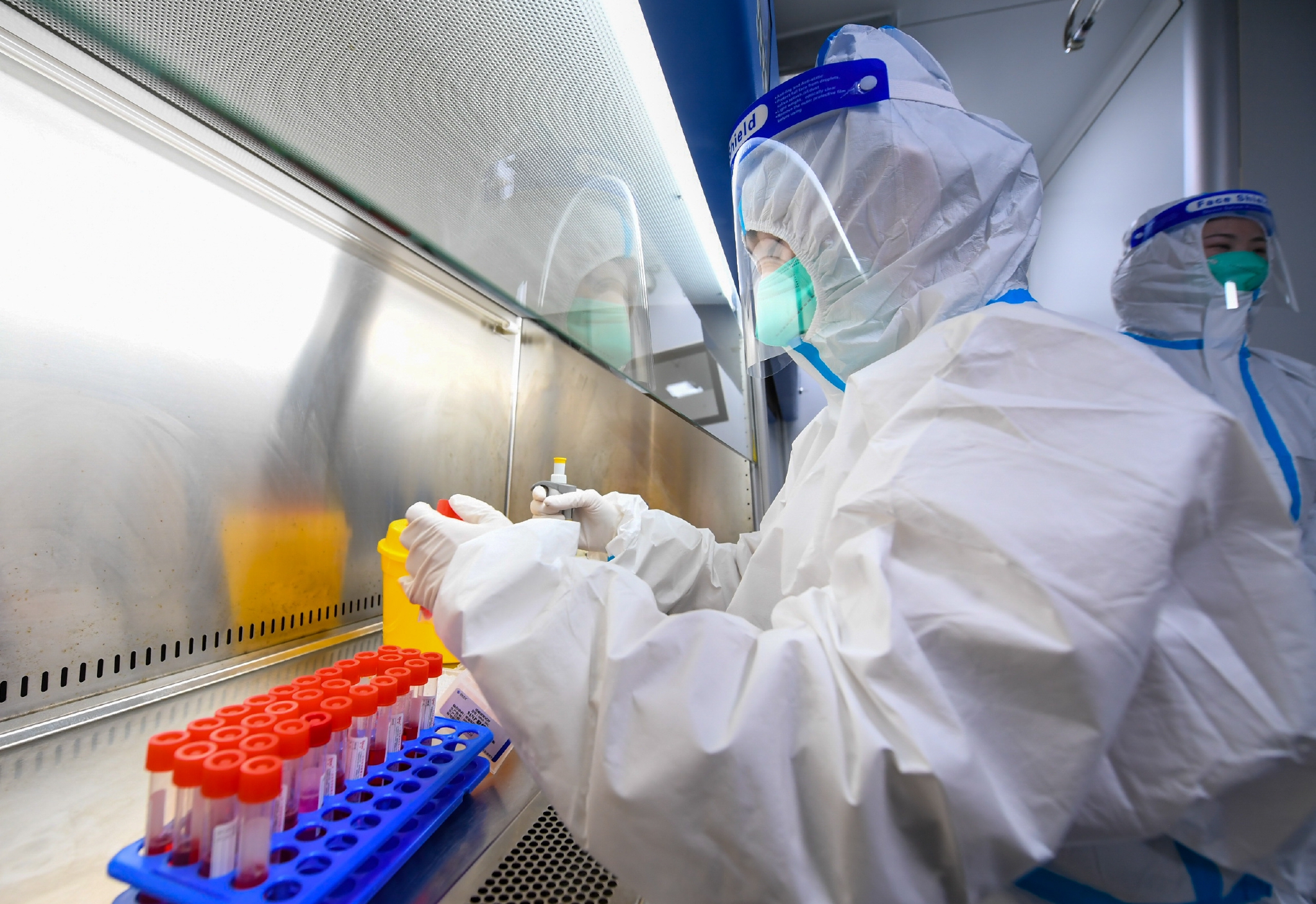 研究发现肺炎易感基因区域