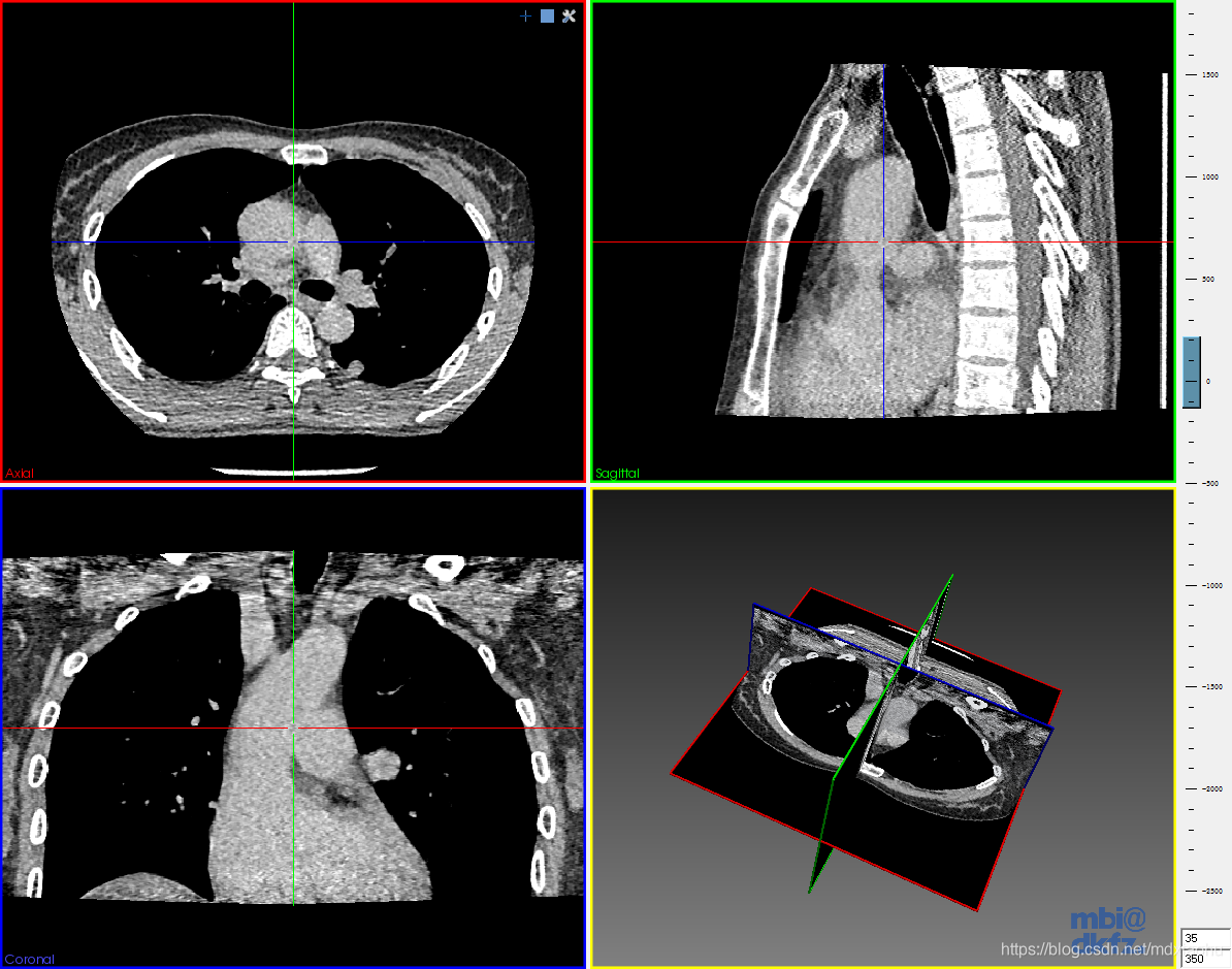 新研究用医学CT技术帮助揭示地震历史